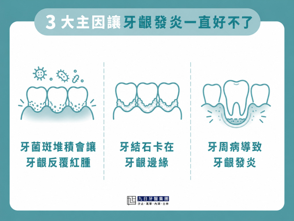 3-大主因讓牙齦發炎一直好不了