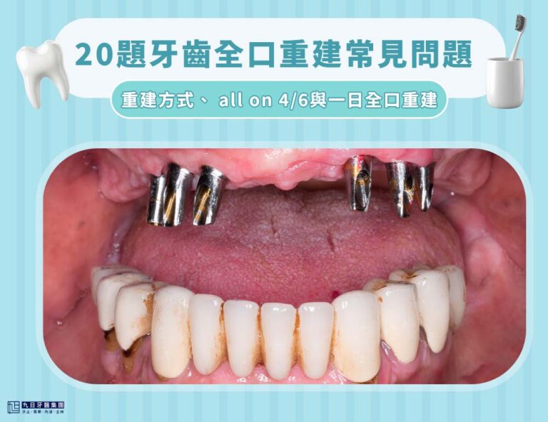 全口重建