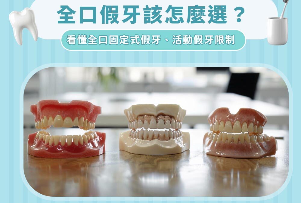 全口假牙