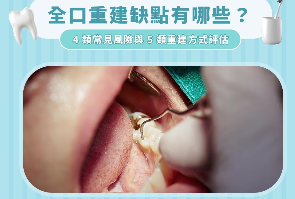 全口重建缺點