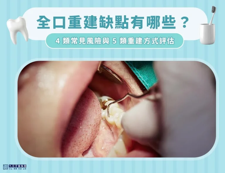 全口重建缺點