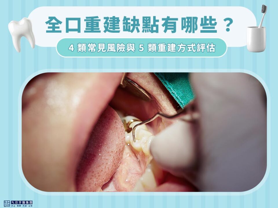 全口重建缺點